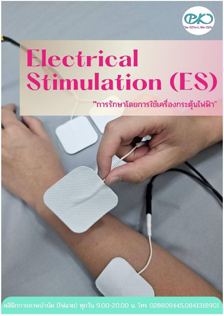 Electrical Stimulation (ES)